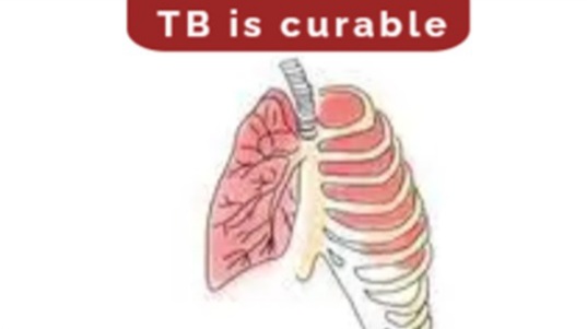 Orange Farm intensifies TB screening and testing ahead of World TB Day